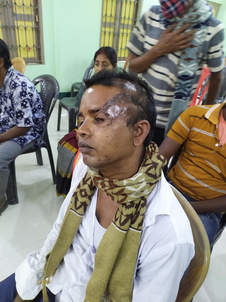 Gour Hari Maity was attacked by a Tiger in 2021.